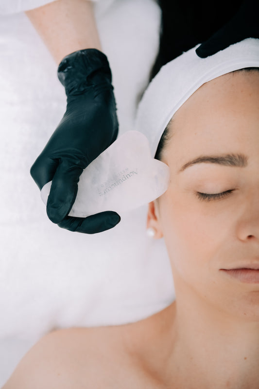 Cosmetic Acupuncture Gift Voucher